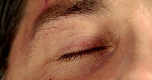 500x_eye52410